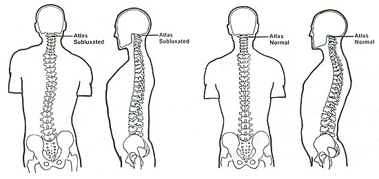 atlas orthogonal chiropractic