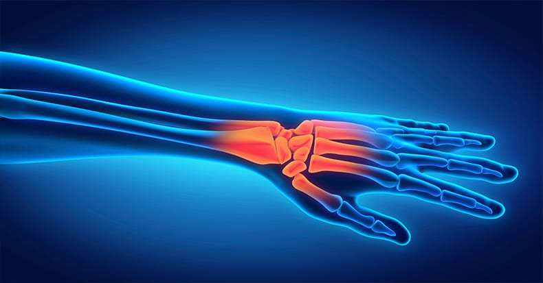 7 Possible Causes of Carpal Tunnel Syndrome