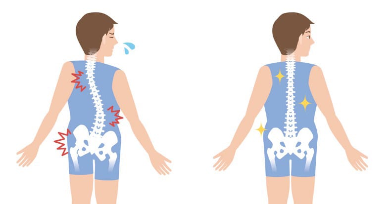 Comparative Analysis of Individuals With and Without Chiropractic Coverage