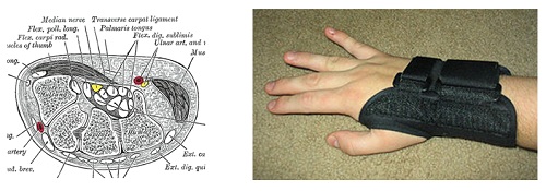 cross section of the carpal tunnel