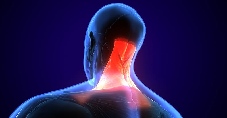 Whiplash and Muscle Weakness