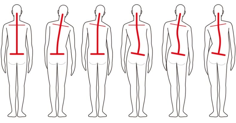 Posture Concepts