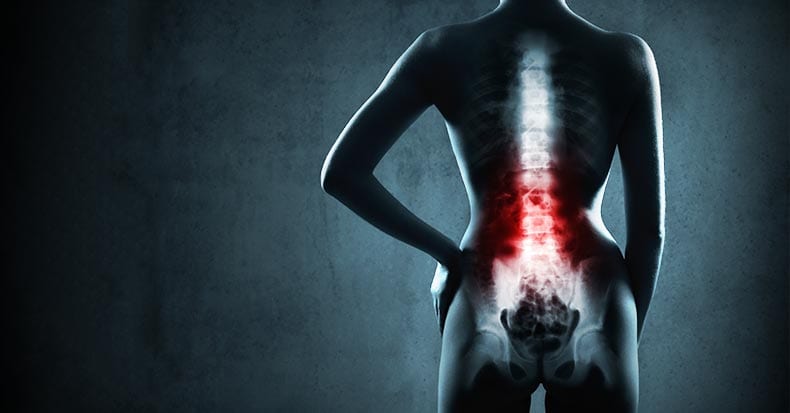 Chiropractic Care and X-Rays for Low Back Pain