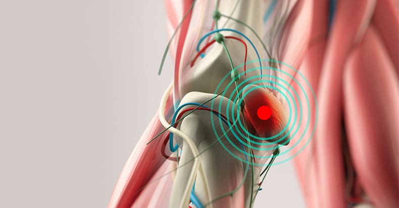 Causes of Knee Pain