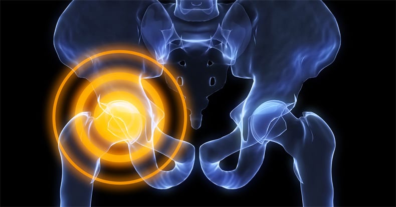 Labral tear hip pain