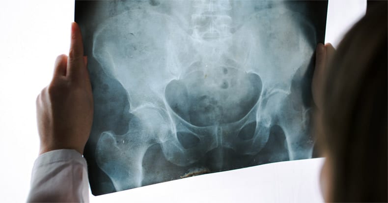 Hip xray doctor